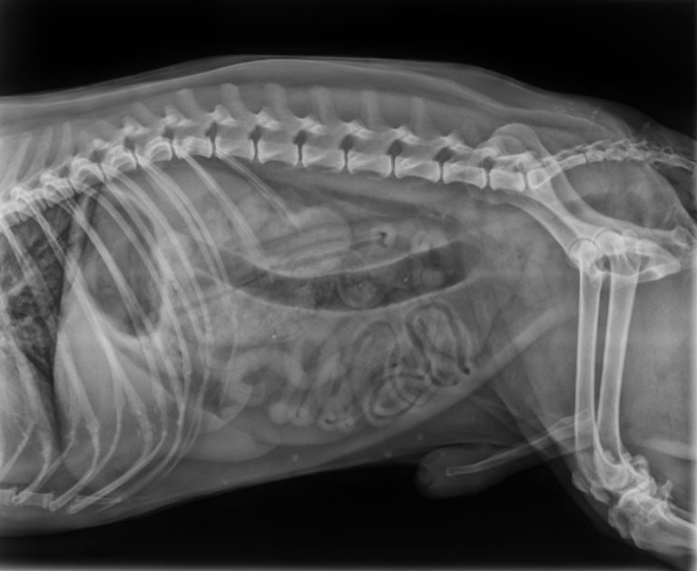 radiografia cas clinic obstruccio colon de willi